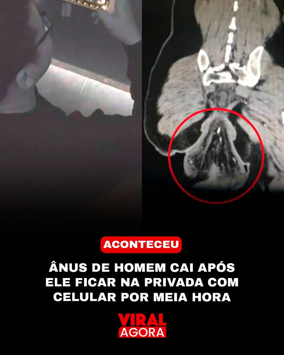 ooooo cu froxo da porrakkkkk